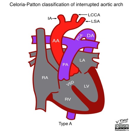 Image | Radiopaedia.org