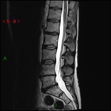 Image | Radiopaedia.org