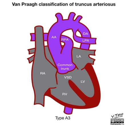 Image | Radiopaedia.org