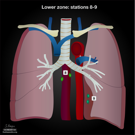 Image | Radiopaedia.org