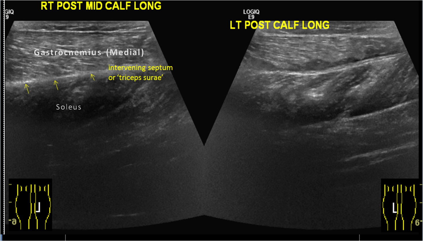 Image | Radiopaedia.org