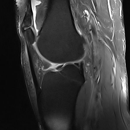 Playlist 'Diagnostic Imaging 1-Week 10 Lower Extremity' by Dr. Sandra ...