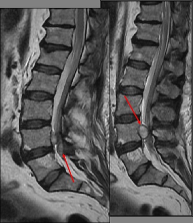 Image | Radiopaedia.org