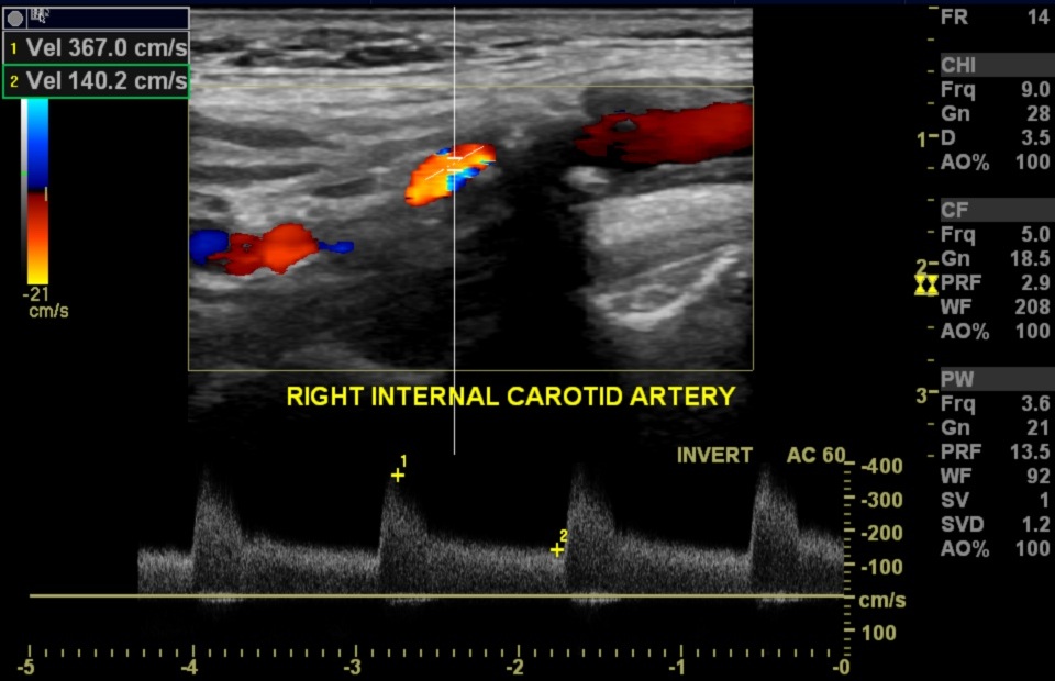 Image | Radiopaedia.org