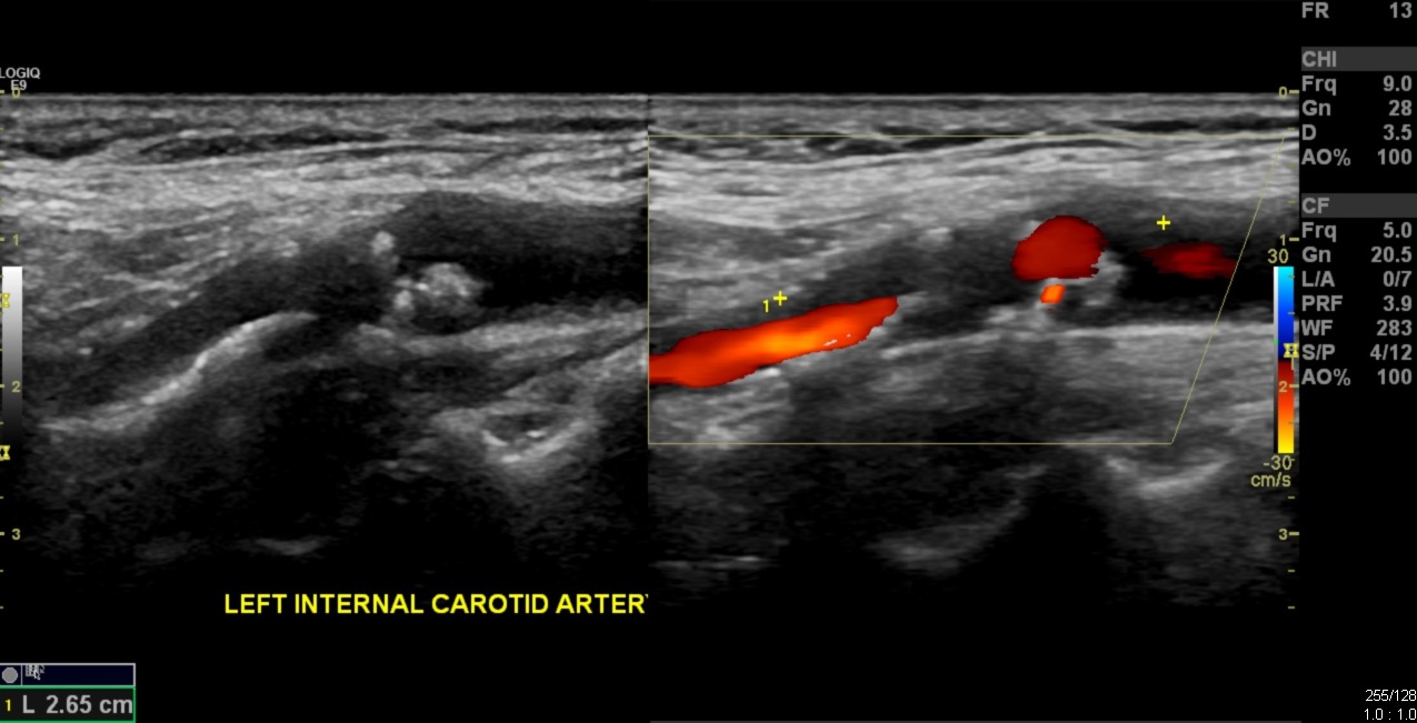 Image | Radiopaedia.org