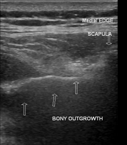 Image | Radiopaedia.org