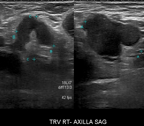 Image | Radiopaedia.org