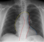 Viewing playlist: CARDIOLOGY CHAPTER 1 | Radiopaedia.org