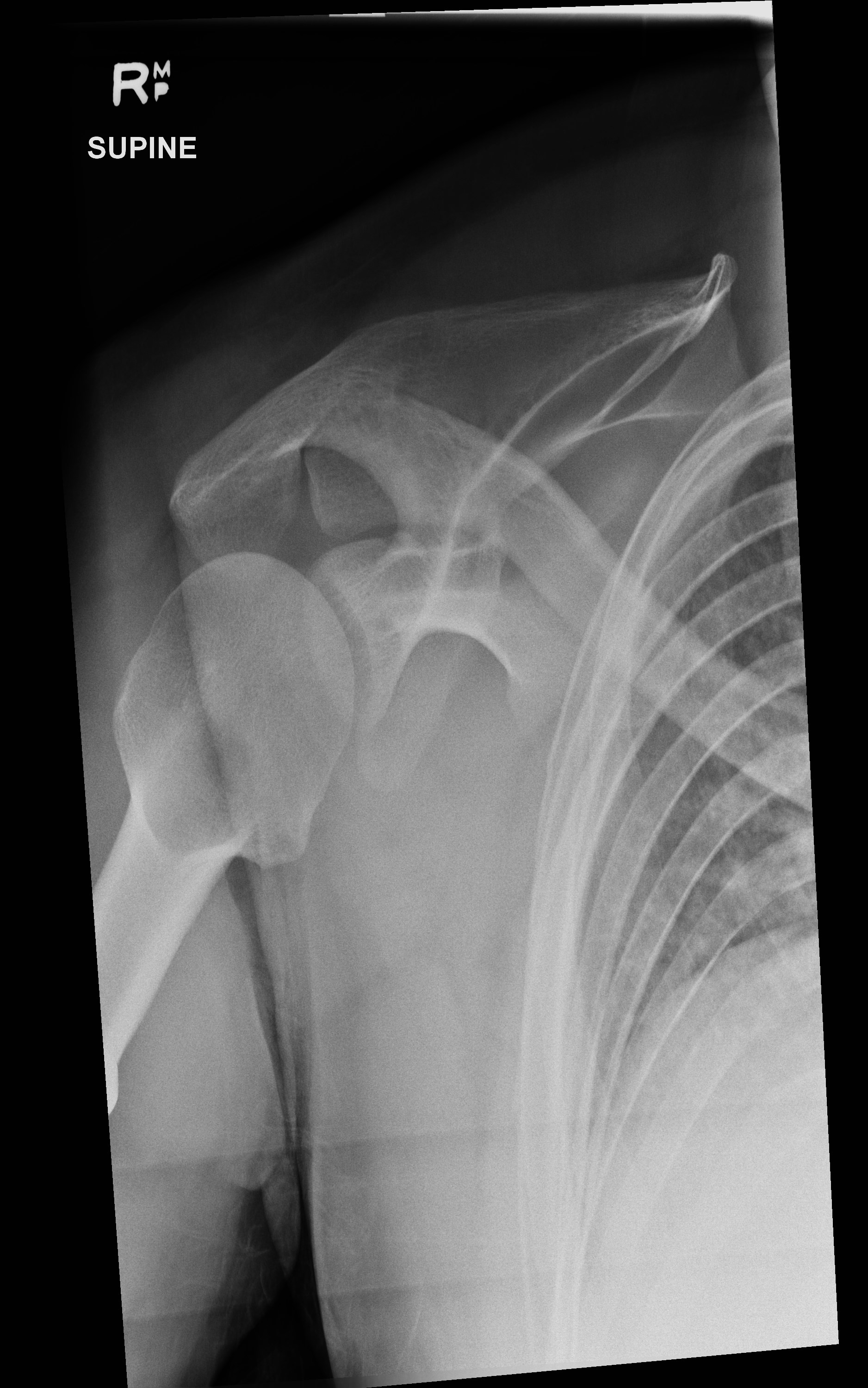 Modality: X-ray (Modified trauma axial.