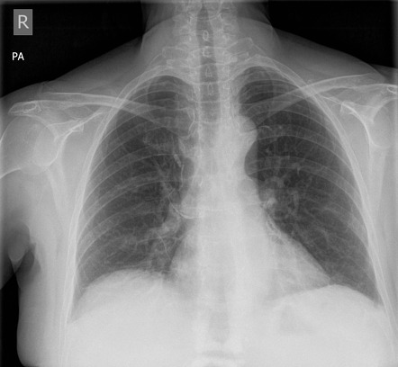 Radiology Quiz 22072 | Radiopaedia.org