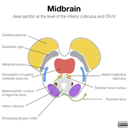 Image | Radiopaedia.org