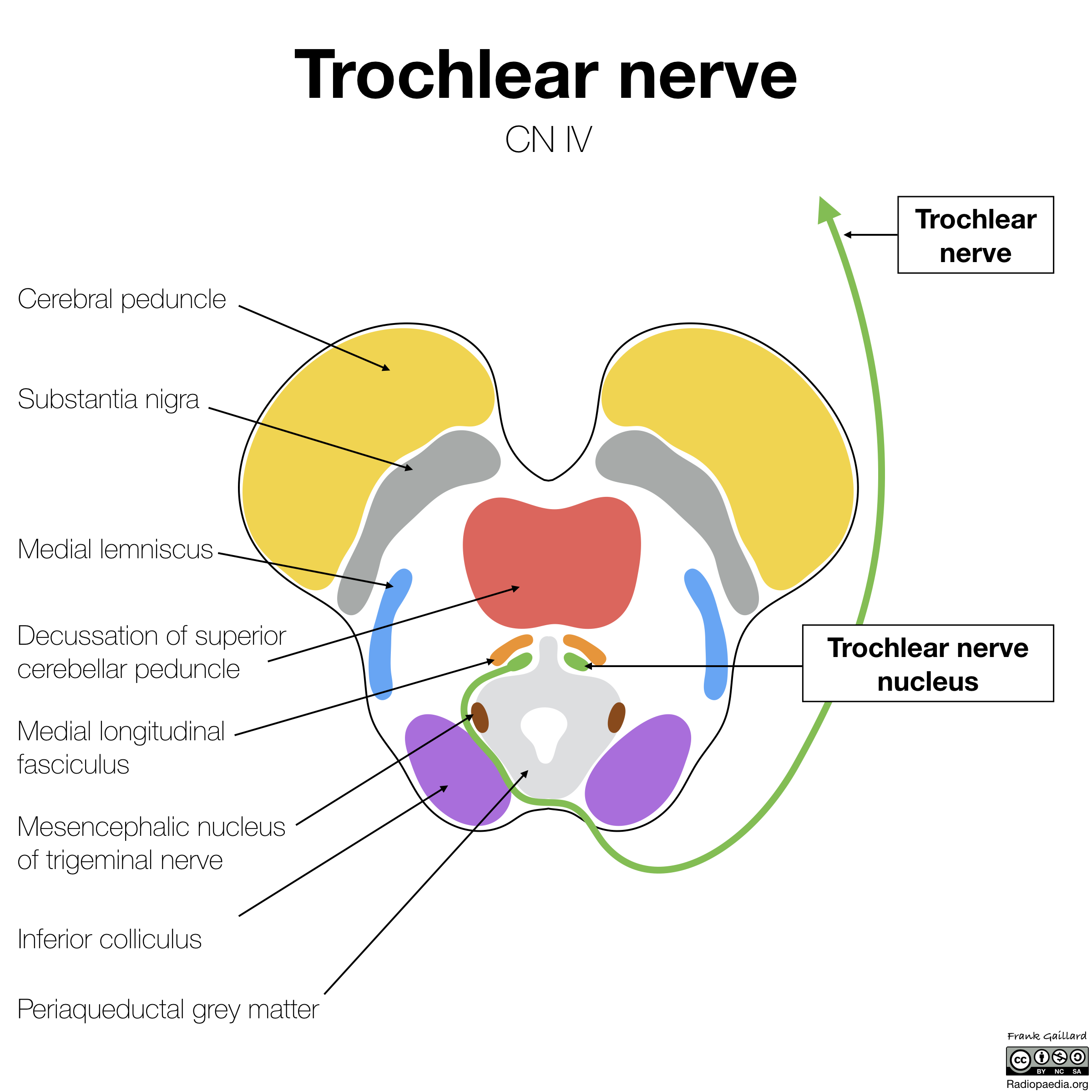 image-radiopaedia