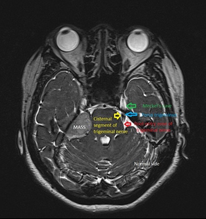 Image | Radiopaedia.org