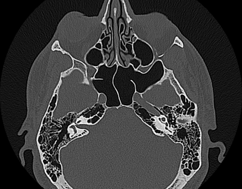 Image | Radiopaedia.org