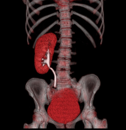 Radiology Quiz 22332 | Radiopaedia.org