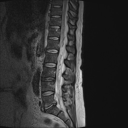 Viewing playlist: SPINE | Radiopaedia.org