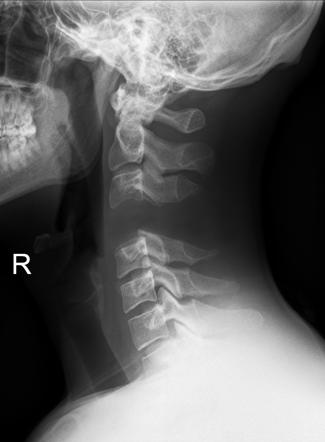 April Fools' | Radiology Reference Article | Radiopaedia.org