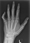 Radiology Quiz 54253 | Radiopaedia.org