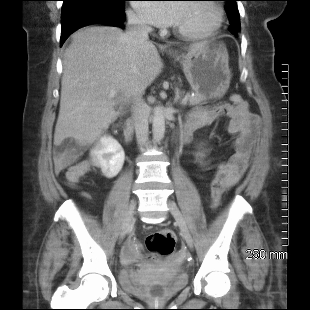 Radiology Quiz 54425 Radiopaedia Playlist Acute Surgical