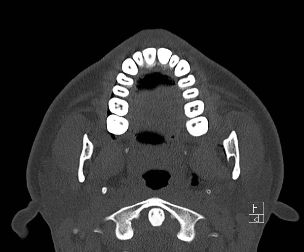 Radiology Quiz 54433 | Radiopaedia.org