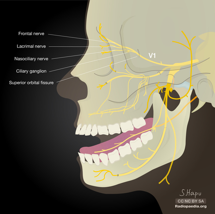 Trigeminal nerve | Radiology Reference Article | Radiopaedia.org