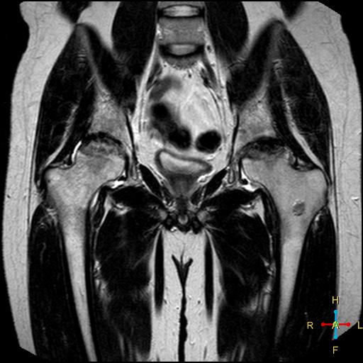 Image | Radiopaedia.org