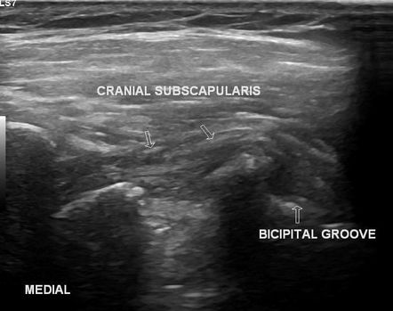 Image | Radiopaedia.org