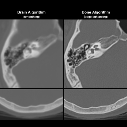 Average File Size Of Ct Scan - ct scan machine