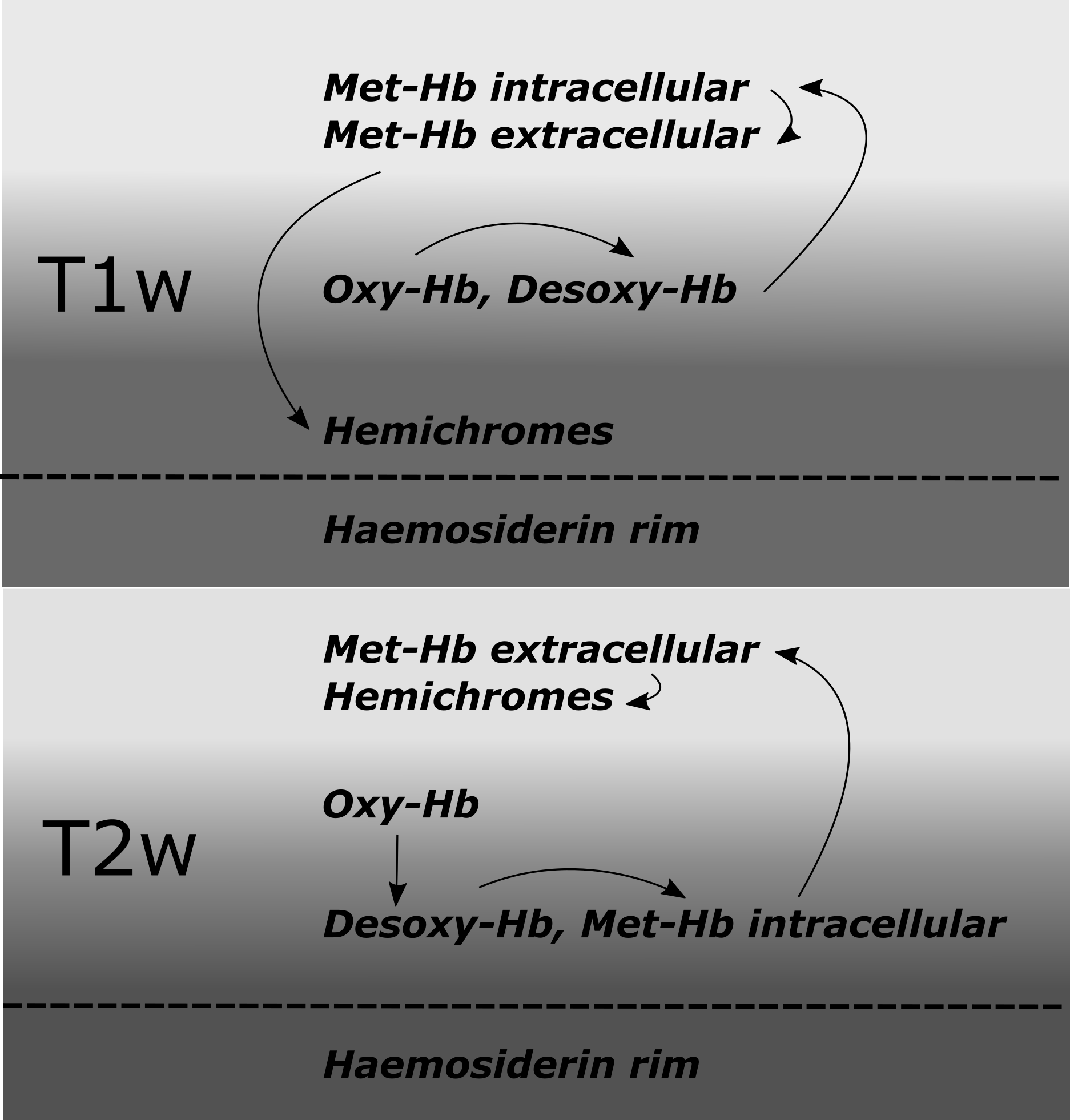 timeline-diagram-of-mri-and-ct-characteristics-of-intracerebral