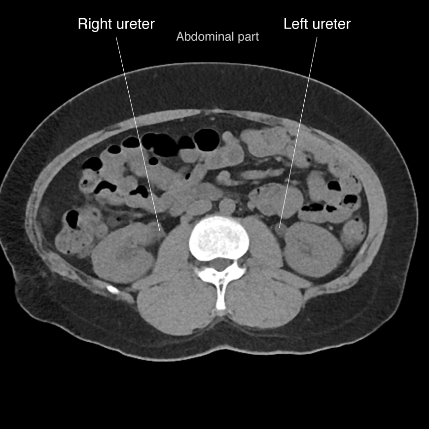 Image | Radiopaedia.org