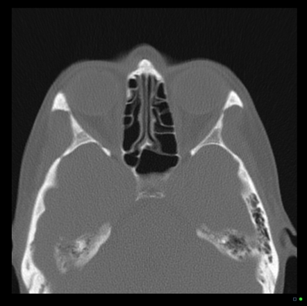 Viewing playlist: Annotated Anatomy | Radiopaedia.org