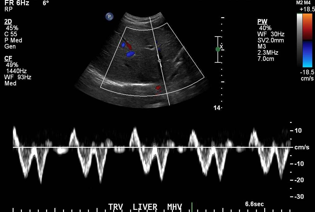 Image | Radiopaedia.org