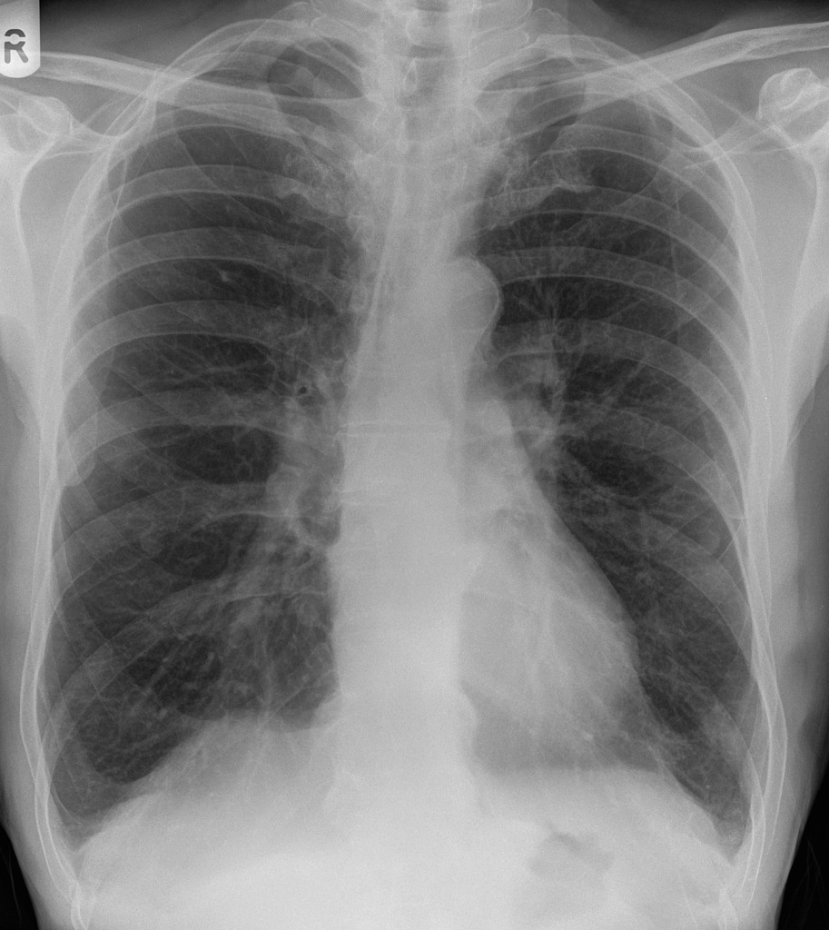 Featured image of post Radiopaedia Org App Fue desarrollada hace unos a os por radiopaedia org la wiki por excelencia de la radiolog a