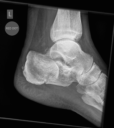 Radiographer abnormality detection system | Radiology Reference Article ...