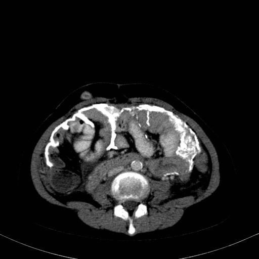 Radiology Quiz 8828 | Radiopaedia.org