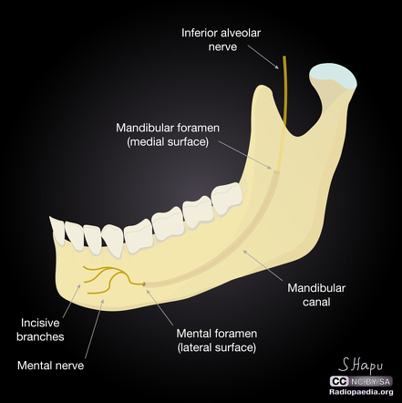 Inferior alveolar nerve | Radiology Reference Article | Radiopaedia.org