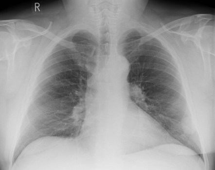 Radiology Quiz 57803 | Radiopaedia.org