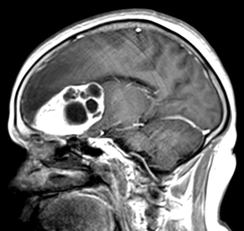 Radiology Quiz 58373 | Radiopaedia.org