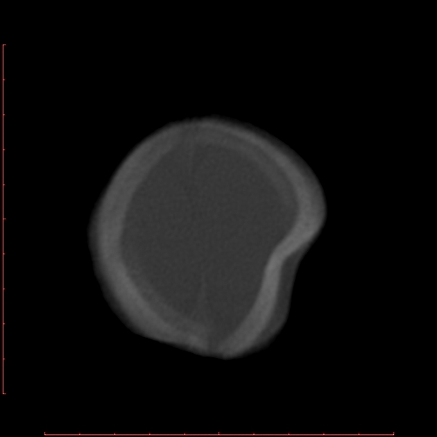 Diagnostics  Free Full-Text  Initial Imaging of Pregnant Patients in the  Trauma BayampmdashDiscussion and Review of Presentations at a Level-1 Trauma  Centre