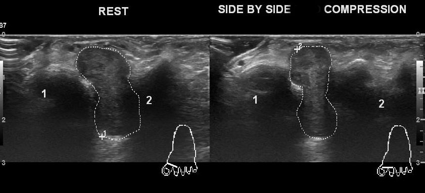 Image | Radiopaedia.org