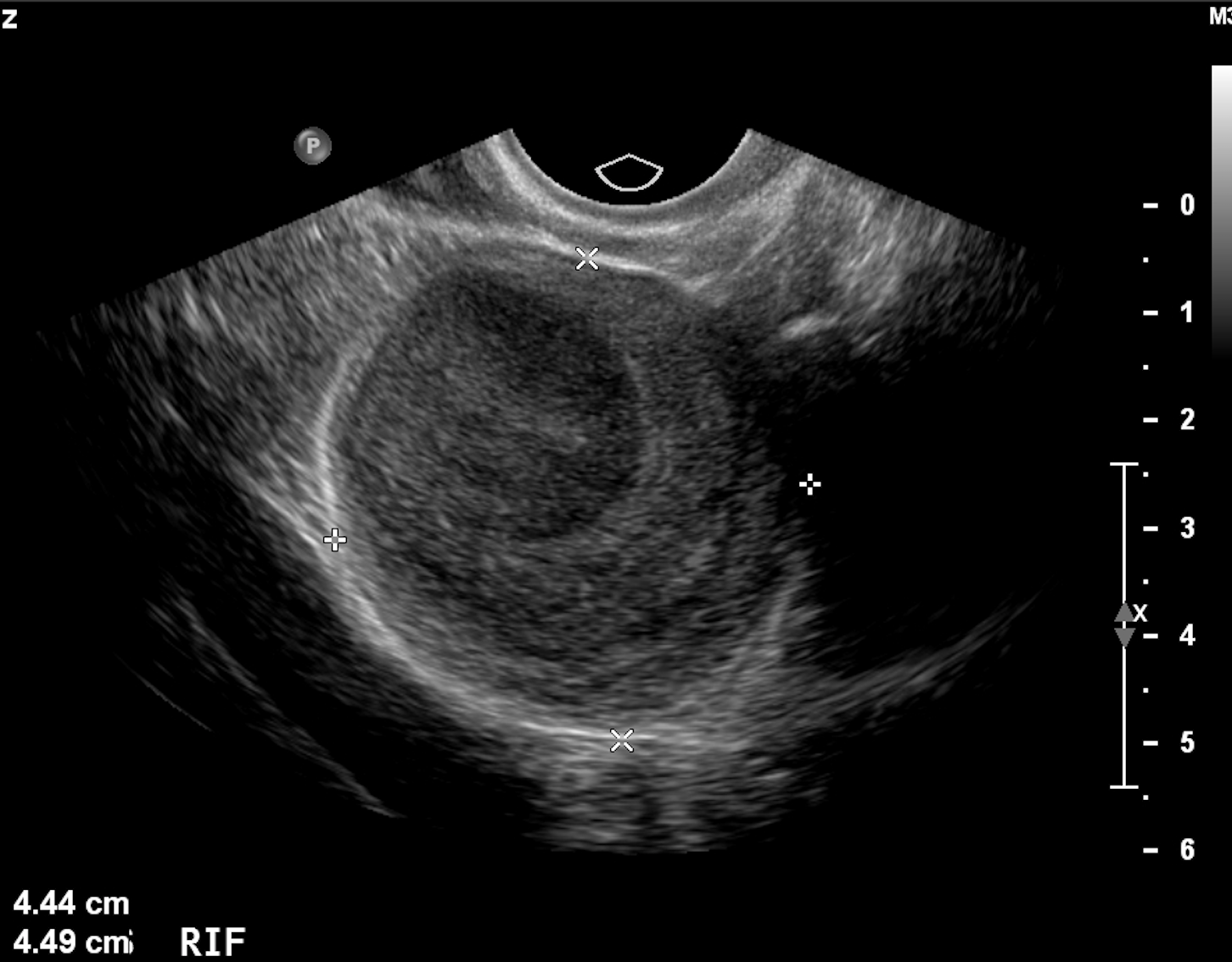 image-radiopaedia