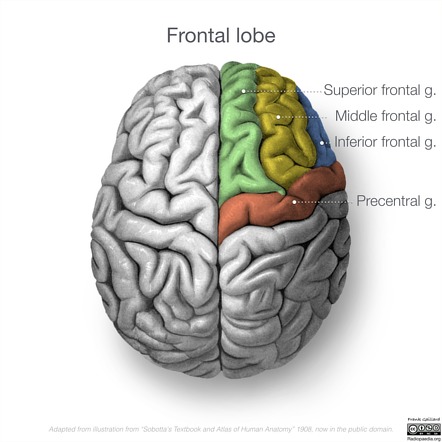 Middle frontal gyrus | Radiology Reference Article | Radiopaedia.org