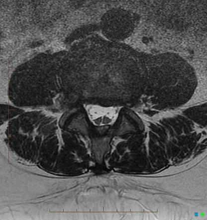 Viewing Playlist: Cases Rf 