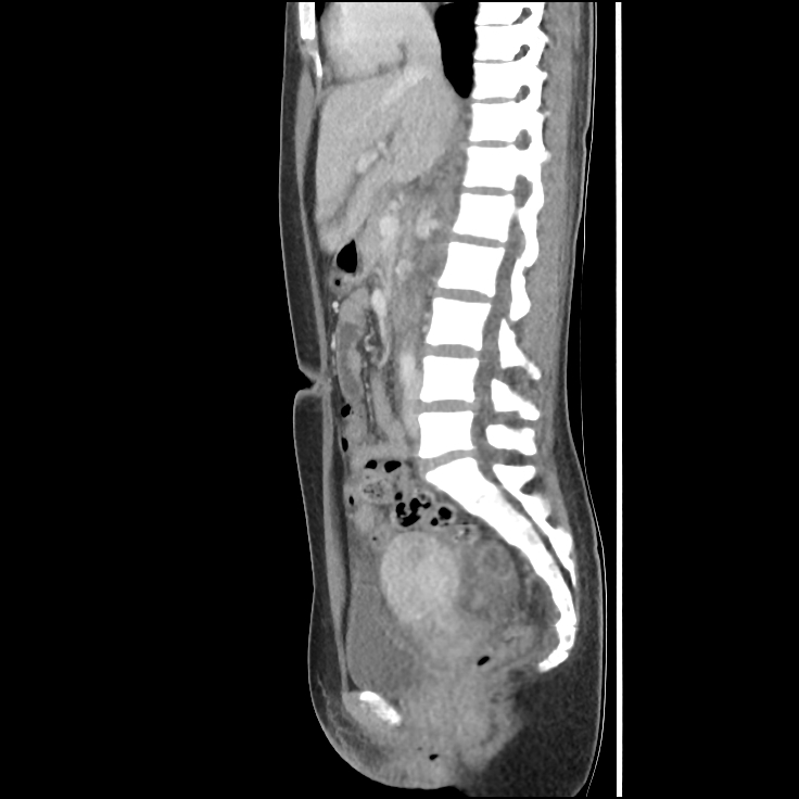 case study 68 pelvic inflammatory disease