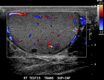 Image | Radiopaedia.org