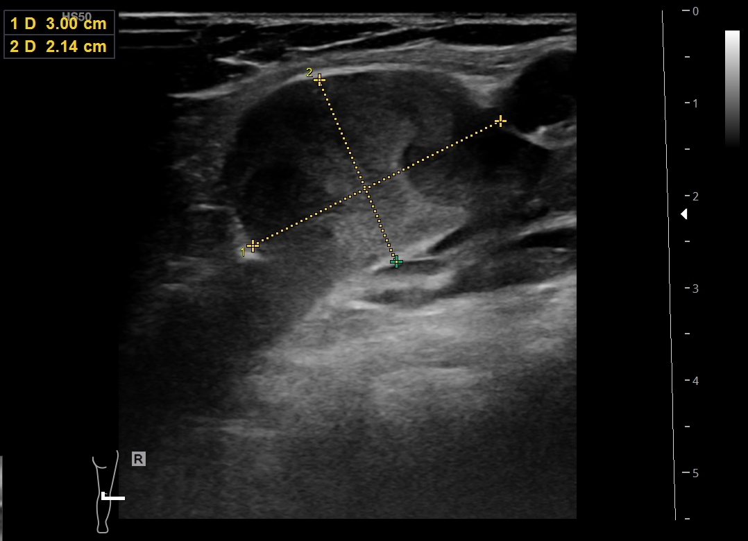 Image Radiopaedia Org