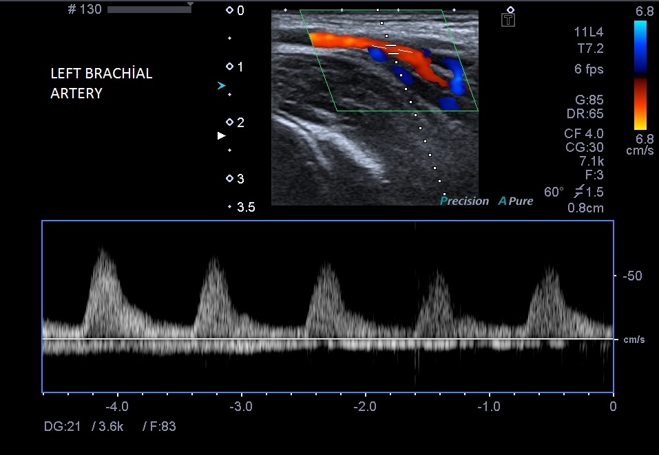 Image | Radiopaedia.org