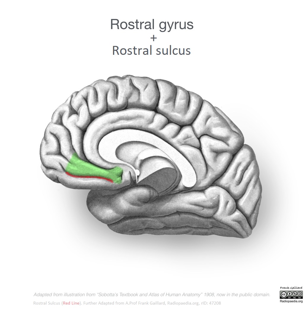 Image | Radiopaedia.org