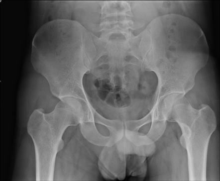 Viewing playlist: Extremity radiographs | Radiopaedia.org