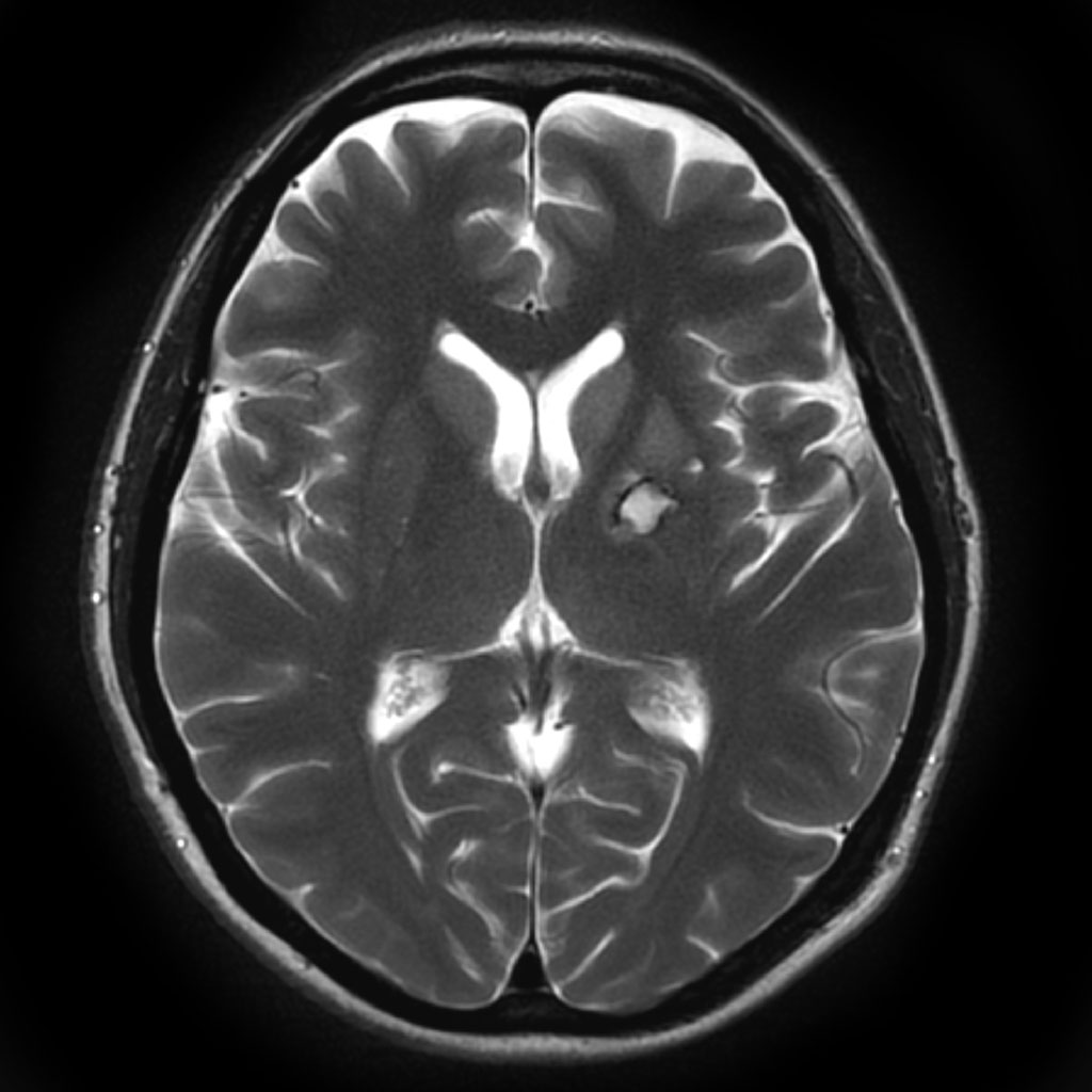 Mr da. MRI т1 т2. Normal MRI. Brain MRI. MRI Brain in Parkinson.